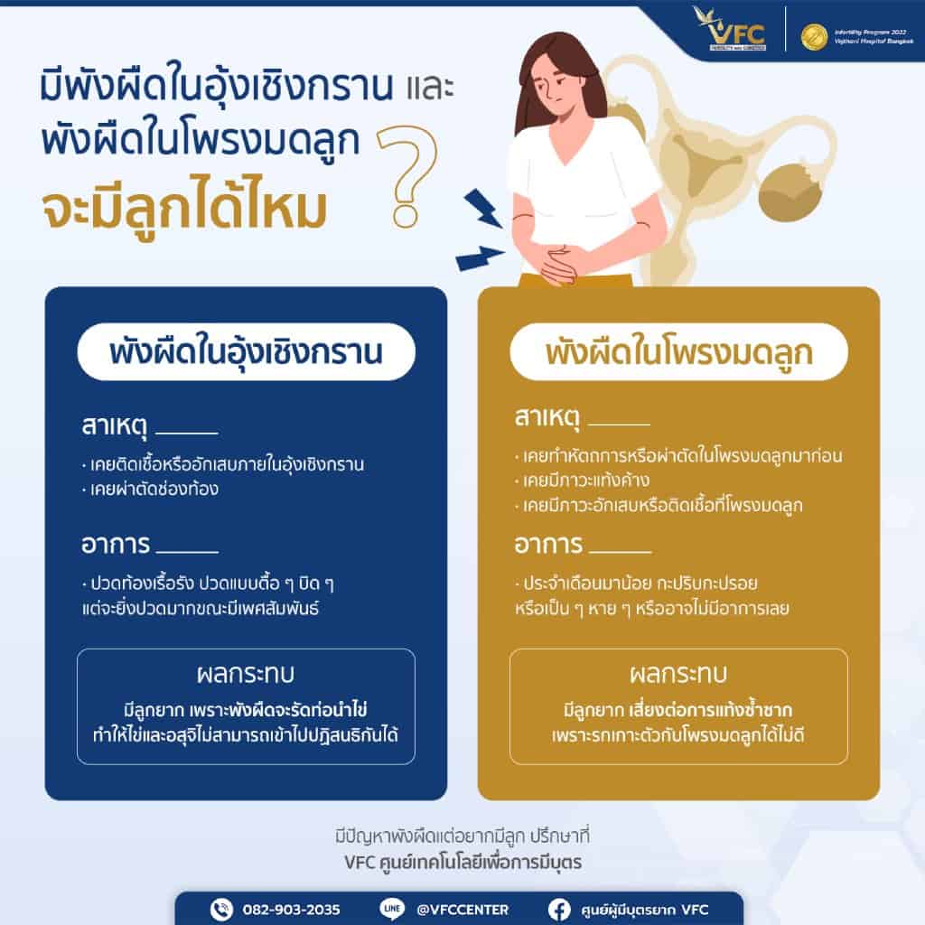 อินโฟกราฟิกเกี่ยวกับการมีพังผืดในโพรงมดลูกและพังผืดในอุ้งเชิงกราน ทำให้มีบุตรยาก