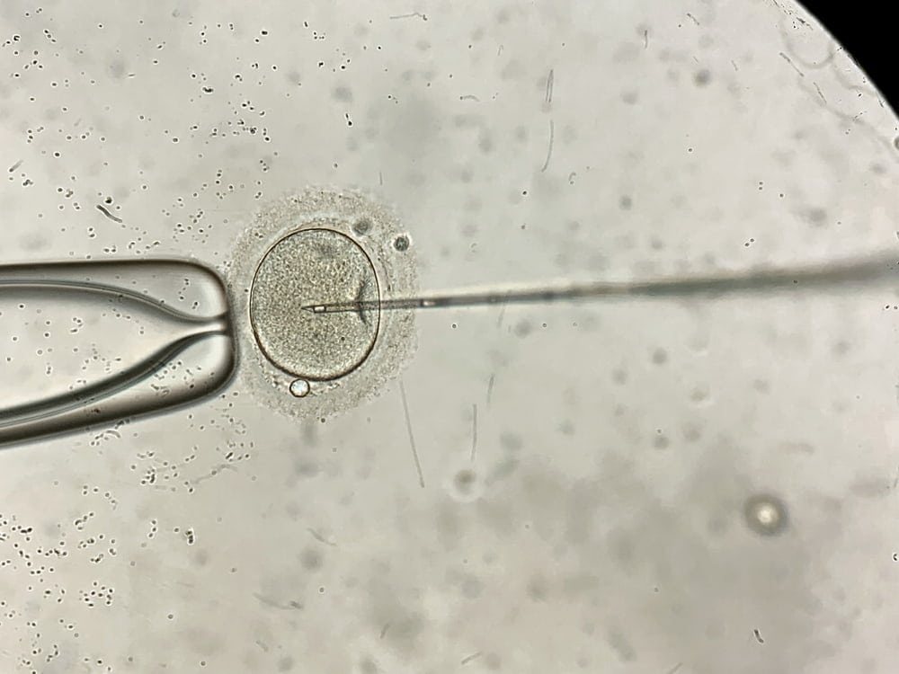 A microscopic view of an egg being fertilized.