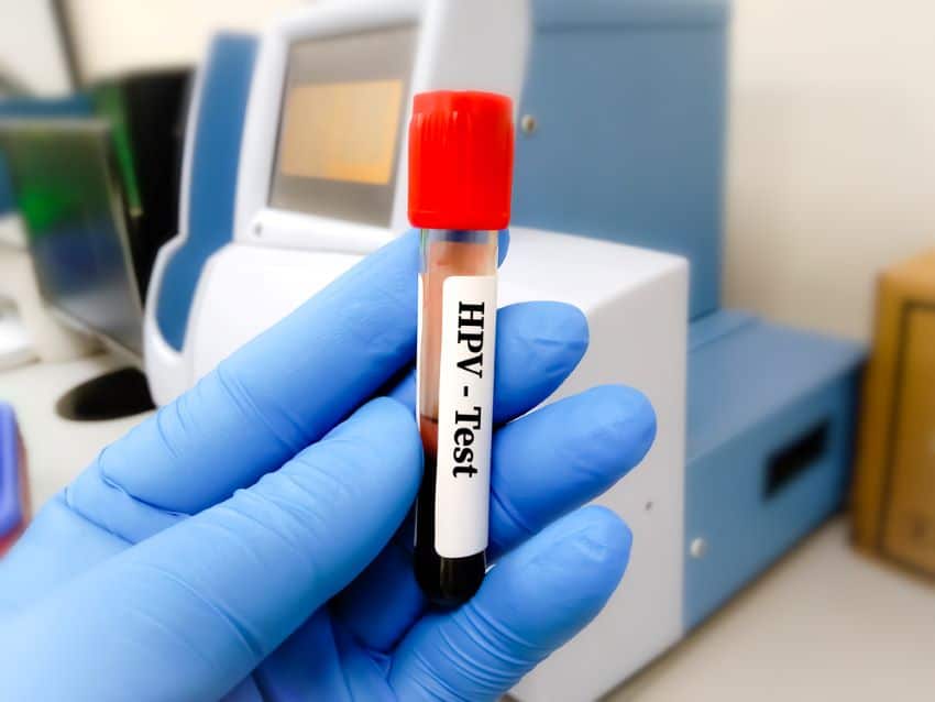 HPV testing is one of the health screenings that should be done when planning for