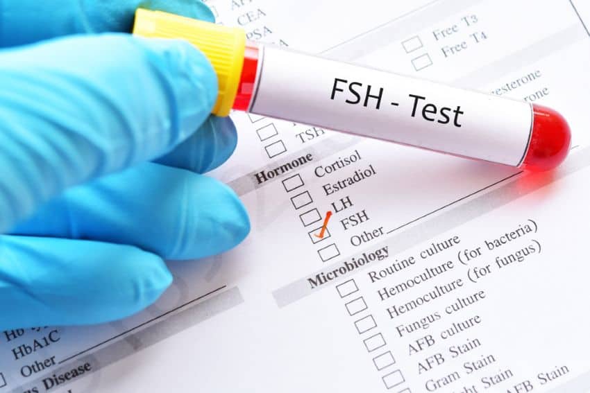 Hormone and ultrasound testing to monitor ovulation symptoms.
